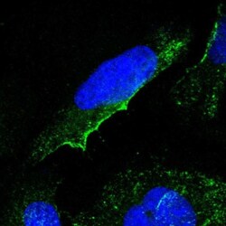 GNG2 Antibody, Novus Biologicals 0.1mL; Unlabeled:Antibodies, Polyclonal